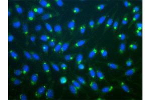 Immunofluorescent staining of aggresomes of mouse L-cells treated with lactacysteine, using RPS27A polyclonal antibody .