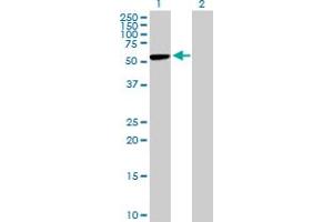 Western Blot analysis of CBS expression in transfected 293T cell line by CBS MaxPab polyclonal antibody. (CBS antibody  (AA 1-551))