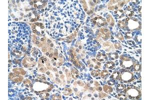 SLC22A7 antibody was used for immunohistochemistry at a concentration of 4-8 ug/ml to stain Epithelial cells of renal tubule (arrows) in Human Kidney.