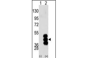 Western blot analysis of PHKG2 (arrow) using PHKG2 Antibody (N-term) (ABIN391341 and ABIN2841365). (PHKG2 antibody  (N-Term))