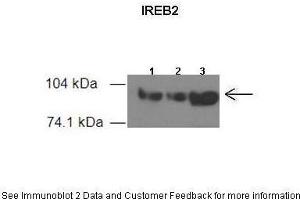 Western Blotting (WB) image for anti-Iron-Responsive Element Binding Protein 2 (IREB2) (Middle Region) antibody (ABIN2778884) (IREB2 antibody  (Middle Region))