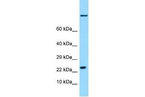 WB Suggested Anti-HSPB9 Antibody Titration: 1. (HSPB9 antibody  (Middle Region))