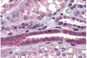 Human Kidney (formalin-fixed, paraffin-embedded) stained with SSX2IP antibody ABIN462255 followed by biotinylated goat anti-rabbit IgG secondary antibody ABIN481713, alkaline phosphatase-streptavidin and chromogen. (SSX2IP antibody  (AA 362-411))