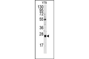 Image no. 1 for anti-Ubiquitin-Conjugating Enzyme E2E 3 (UBE2E3) (N-Term) antibody (ABIN357598) (UBE2E3 antibody  (N-Term))