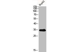 ACER1 antibody  (Internal Region)