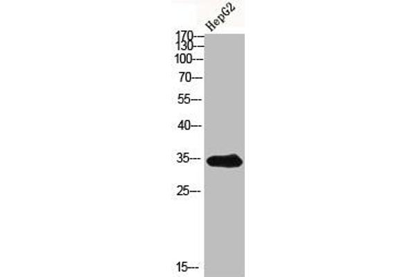 ACER1 antibody  (Internal Region)