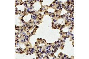 Immunohistochemical analysis of RACK1 staining in rat lung formalin fixed paraffin embedded tissue section. (GNB2L1 antibody)