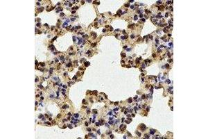 Immunohistochemistry (IHC) image for anti-Guanine Nucleotide Binding Protein (G Protein), beta Polypeptide 2-Like 1 (GNB2L1) antibody (ABIN7307828)
