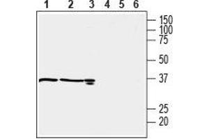 Western blot analysis of mouse kidney (lanes 1 and 4), rat kidney (lanes 2 and 5) (1:600) and rat testis (lanes 3 and 6) (1:200) lysates: - 1-3. (OXGR1 antibody  (C-Term, Intracellular))