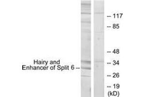 Western blot analysis of extracts from HeLa cells, using HES6 Antibody.