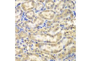 Immunohistochemistry of paraffin-embedded mouse kidney using MBP antibody (ABIN5970825) at dilution of 1/200 (40x lens). (MBP antibody)