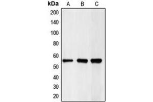 Western blot analysis of CHK1 expression in HeLa (A), mouse kidney (B), rat heart (C) whole cell lysates. (CHEK1 antibody  (Center))