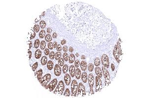 colon descendens mucosa (Recombinant Villin 1 antibody  (AA 600-700))