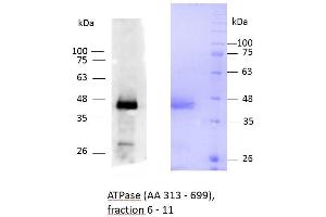 Image no. 2 for ATPase, Ca++ Transporting, Type 2C, Member 1 (ATP2C1) (AA 313-699) protein (His tag) (ABIN3099226) (ATP2C1 Protein (AA 313-699) (His tag))