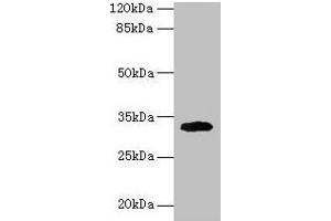 Western blot All lanes: Cd74 antibody at 2 μg/mL + Mouse lung tissue Secondary Goat polyclonal to rabbit IgG at 1/10000 dilution Predicted band size: 32, 25 kDa Observed band size: 32 kDa (CD74 antibody  (AA 57-280))