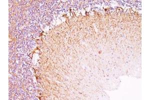 Formalin-fixed, paraffin-embedded human cerebellum stained with Neurofilament antibody (NR-4). (Neurofilament antibody)