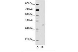Image no. 1 for anti-Homeobox Containing 1 (HMBOX1) (N-Term) antibody (ABIN202481) (HMBOX1 antibody  (N-Term))