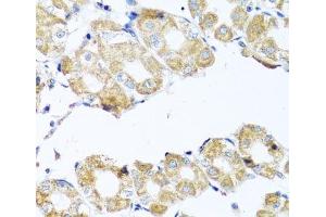Immunohistochemistry of paraffin-embedded Human stomach using COQ7 Polyclonal Antibody at dilution of 1:100 (40x lens).