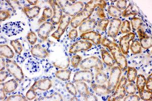 AK2 was detected in paraffin-embedded sections of mouse kidney tissues using rabbit anti- AK2 Antigen Affinity purified polyclonal antibody (Catalog # ) at 1 µg/mL. (Adenylate Kinase 2 antibody  (AA 161-239))