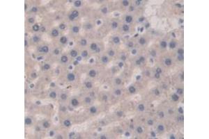 IHC-P analysis of Rat Tissue, with DAB staining. (Vitamin D-Binding Protein antibody  (AA 395-475))