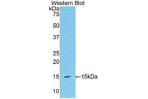 Western blot analysis of the recombinant protein. (HPSE antibody  (AA 419-535))