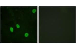 Immunofluorescence analysis of HeLa cells, using Cyclin H (Ab-315) Antibody.