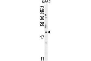 BTG2 Antibody (N-term) western blot analysis in K562 cell line lysates (35µg/lane). (BTG2 antibody  (N-Term))