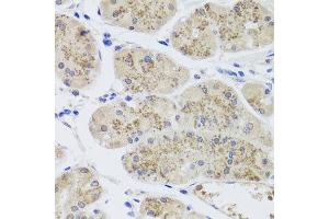 Immunohistochemistry of paraffin-embedded human stomach using MTERFD3 antibody at dilution of 1:100 (x40 lens). (MTERFD3 antibody)