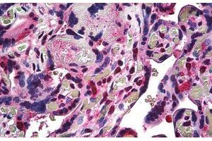 Human Placenta: Formalin-Fixed, Paraffin-Embedded (FFPE) (RBX1 antibody  (C-Term))