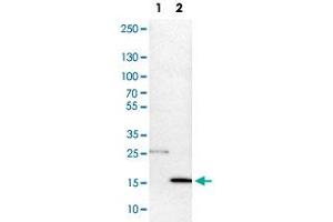 Western Blot analysis of Lane 1: NIH-3T3 cell lysate (mouse embryonic fibroblast cells) and Lane 2: NBT-II cell lysate (Wistar rat bladder tumor cells) with DNAL4 polyclonal antibody .