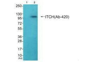 Western blot analysis of extracts from HepG2 cells (Lane 2), using ITCH (Ab-420) antiobdy. (ITCH antibody  (Tyr420))