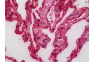 Human Lung: Formalin-Fixed, Paraffin-Embedded (FFPE).