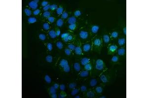 IF analysis of IQGAP1 using anti-IQGAP1 antibody (ABIN7600509).