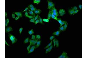 Immunofluorescence staining of HepG2 cells with ABIN7152156 at 1:133, counter-stained with DAPI. (EIF3G antibody  (AA 2-320))