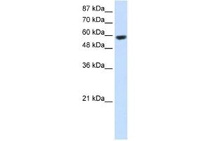 WB Suggested Anti-RNF14 Antibody Titration:  2. (RNF14 antibody  (C-Term))
