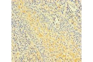 Immunohistochemistry of paraffin-embedded human tonsil tissue using ABIN7153002 at dilution of 1:100 (FNIP1 antibody  (AA 221-508))