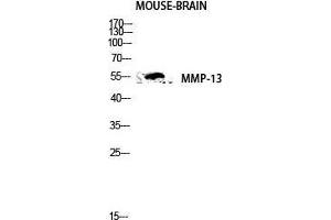 Western Blot (WB) analysis of Mouse Brain lysis using MMP-13 antibody. (MMP13 antibody  (N-Term))