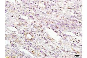 L1 rat kidney lysates L2 rat brain lysates probed with Anti MIIP Polyclonal Antibody, Unconjugated (ABIN758681) at 1:200 in 4 °C. (MIIP antibody  (AA 251-350))