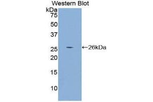 Western Blotting (WB) image for anti-Chromodomain Helicase DNA Binding Protein 3 (CHD3) (AA 1551-1742) antibody (ABIN1858391) (CHD3 antibody  (AA 1551-1742))