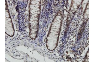 Immunoperoxidase of monoclonal antibody to STAT6 on formalin-fixed paraffin-embedded human colon. (STAT6 antibody  (AA 694-801))