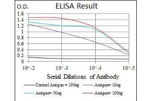 Black line: Control Antigen (100 ng), Purple line: Antigen(10 ng), Blue line: Antigen (50 ng), Red line: Antigen (100 ng), (LRP5 antibody)