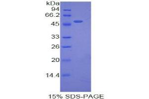 SDS-PAGE analysis of Pig Erythropoietin Protein. (EPO Protein)