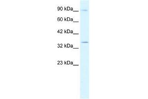 Human Jurkat; WB Suggested Anti-BHLHB5 Antibody Titration: 0. (BHLHE22 antibody  (N-Term))
