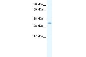 WB Suggested Anti-PDLIM1 Antibody Titration:  0. (PDLIM1 antibody  (Middle Region))