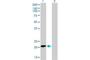 Western Blot analysis of RHOC expression in transfected 293T cell line by RHOC monoclonal antibody (M01), clone 2E12. (RHOC antibody  (AA 1-193))