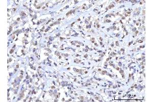 IHC analysis of RANBP2 using anti-RANBP2 antibody (ABIN7602650). (RANBP2 antibody  (AA 906-2744))