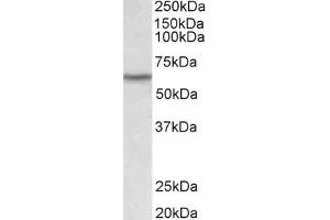 Western Blotting (WB) image for anti-Lymphocyte-Specific Protein tyrosine Kinase (LCK) (AA 39-52) antibody (ABIN1102819) (LCK antibody  (AA 39-52))