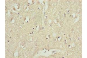 Immunohistochemistry of paraffin-embedded human brain tissue using ABIN7144078 at dilution of 1:100 (CDC26 antibody  (AA 1-85))