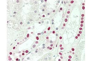 Formalin-fixed and paraffin-embedded H. (SNRPD3 antibody  (C-Term))