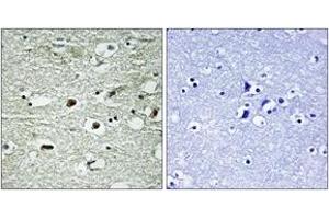 Immunohistochemistry analysis of paraffin-embedded human brain, using hnRNP C1/2 (Phospho-Ser260) Antibody. (HNRNPC antibody  (pSer260))